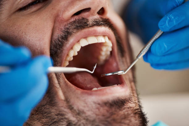 Best Cosmetic Dentistry  in Grangeville, ID
